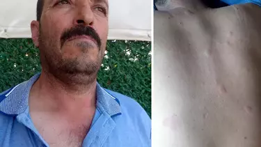 Antalya'da Arıcı Ayıdan Kaçtı, Arılardan Kaçamadı!