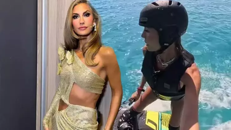 Çağla Şıkel Sörfe Kendini Fazla Kaptırdı: Bacakları Mosmor Oldu!