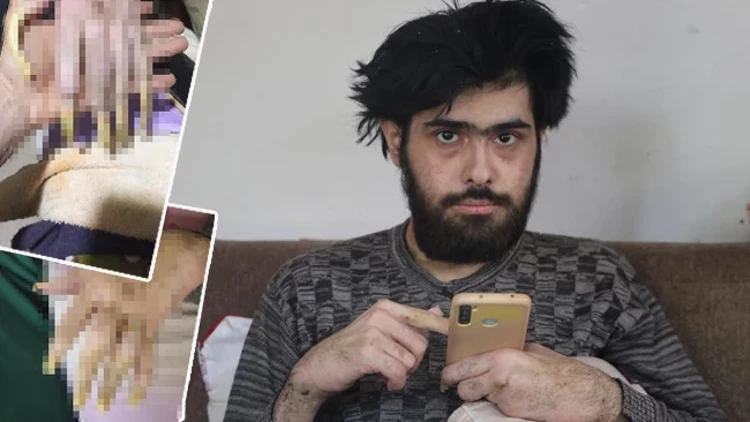 Depremden Sonra Evden Çıkmadı: 3 Yıldır Sadece Telefonla Vakit Geçiriyor