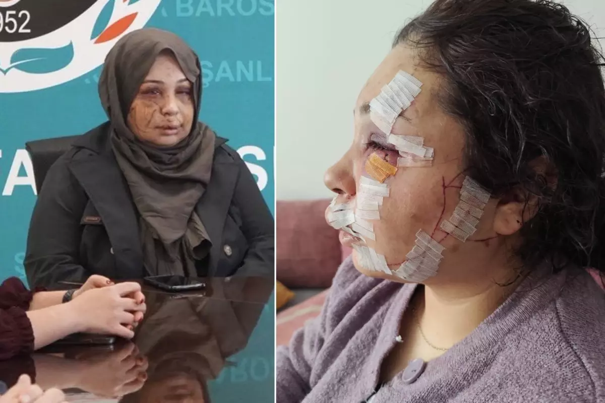 Cumhurbaşkanlığı Koruma Personeli Eşine Şiddet Uyguladı: Tutuklandı