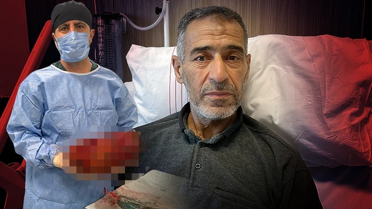 Gaziantep’te 8 Kiloluk Böbrek Ameliyatla Alındı