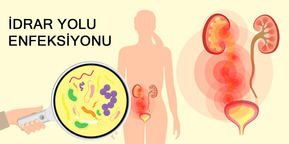 İdrar Yolu Enfeksiyonu Neden Olur? Uzmanlar Uyardı
