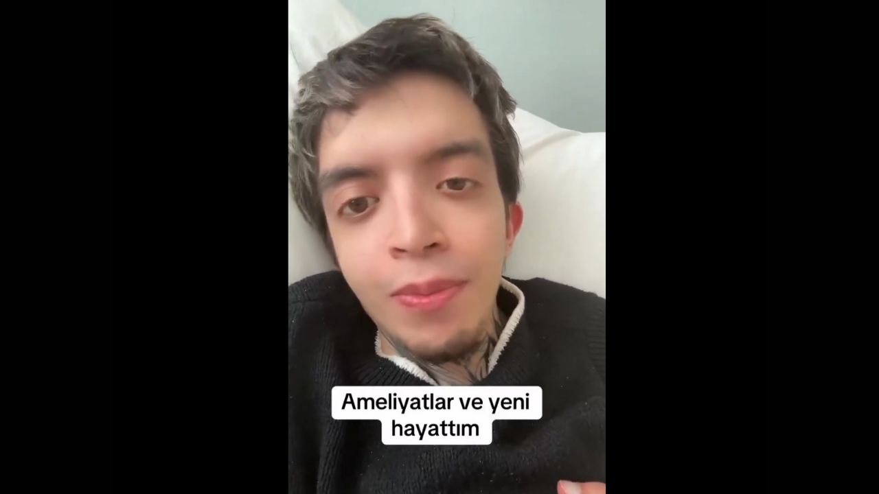 Tablet Reis Cinsiyet Değiştiriyor! Tablet Reis Yeni Yüzü Fotoğrafları