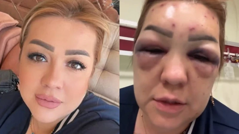 Sosyal Medyada Darp Zannedildi, Gerçek Ortaya Çıkınca Şok Ettiler Sosyal Medyada Darp Zannedildi, Gerçek Ortaya Çıkınca Şok Ettiler