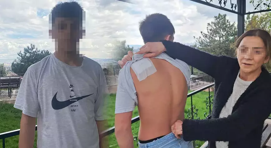 Çocuk Parkta Bıçaklandı, Saldırgan Serbest! Aileden Adalet Çığlığı Çocuk Parkta Bıçaklandı, Saldırgan Serbest! Aileden Adalet Çığlığı