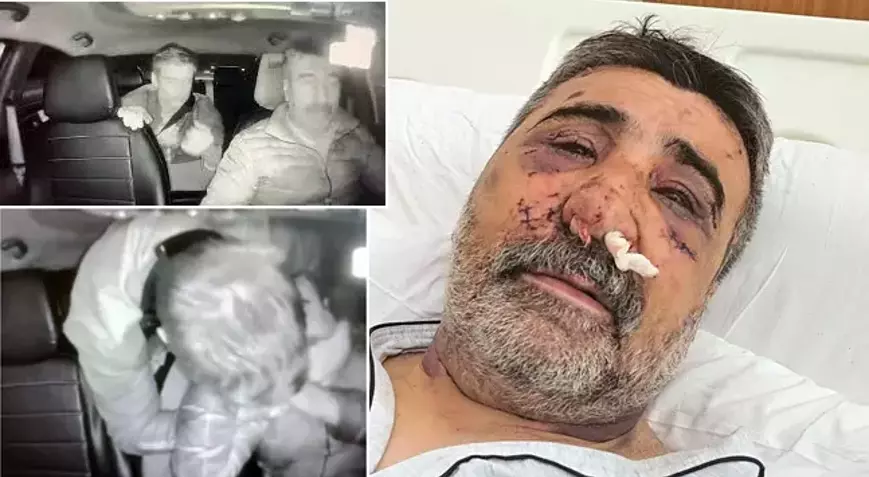Eyüpsultan’da Taksi Şoförüne İngiliz Boksör Dehşeti: “Ellerini Gözüme Sokup Isırdı”