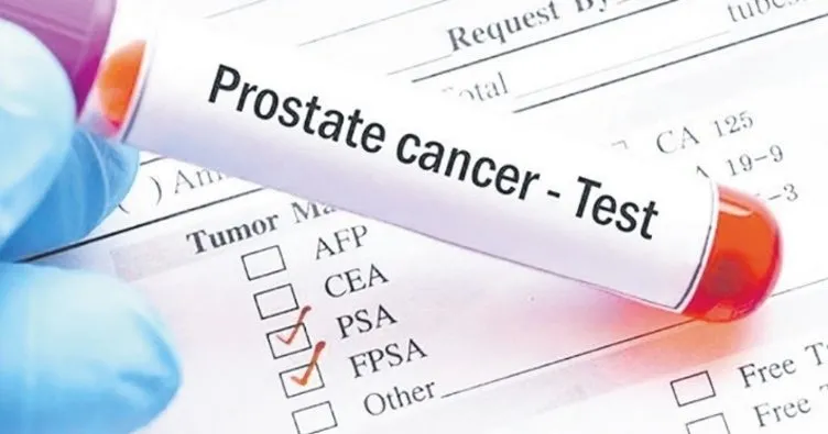 Prostat Kanseri Teşhisinde Yeni Dönem: İdrarda Belirlenen Moleküller Umut Vaat Ediyor