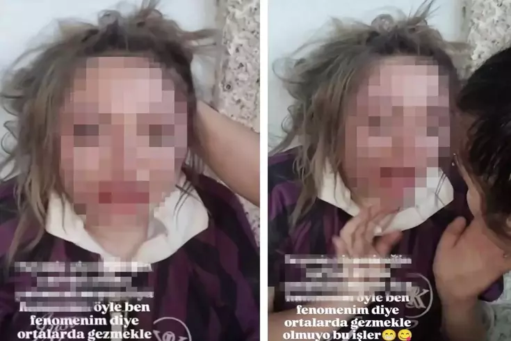 Genç Kızı Darp Edip Özür Dilettiler, Görüntüleri Sosyal Medyada Yayınladılar