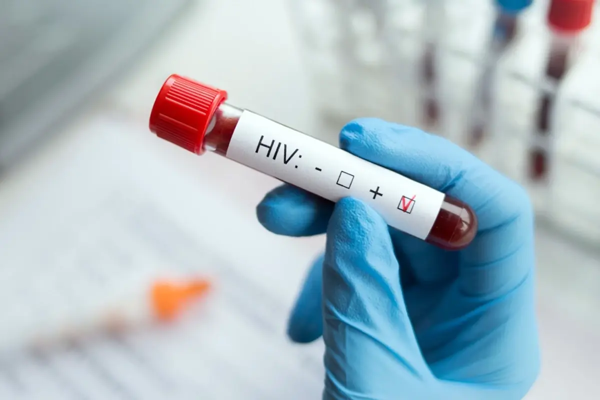 HIV Tedavisinde Devrim Niteliğinde Adım: mRNA Teknolojisi Umut Oldu HIV Tedavisinde Devrim Niteliğinde Adım: mRNA Teknolojisi Umut Oldu