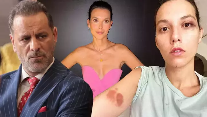 Ozan Güven'e 2 Yıl 3 Ay Hapis Cezası: Deniz Bulutsuz’tan Dikkat Çeken Açıklama Ozan Güven'e 2 Yıl 3 Ay Hapis Cezası: Deniz Bulutsuz’tan Dikkat Çeken Açıklama