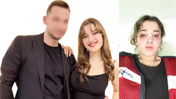 Yalova’da Nişanlısının Şiddetine Uğrayan Hilal Çullu: “Asla Geri Dönmeyeceğim”