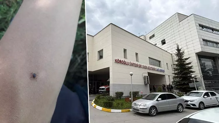 Bolu’da Kene Vakası: 77 Yaşındaki Kadın Yaşamını Yitirdi Bolu’da Kene Vakası: 77 Yaşındaki Kadın Yaşamını Yitirdi