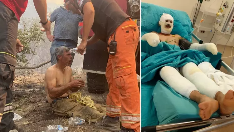 Orman Yangınında Yaralanan İşçi Kader Dereli’nin Son Durumu Paylaşıldı