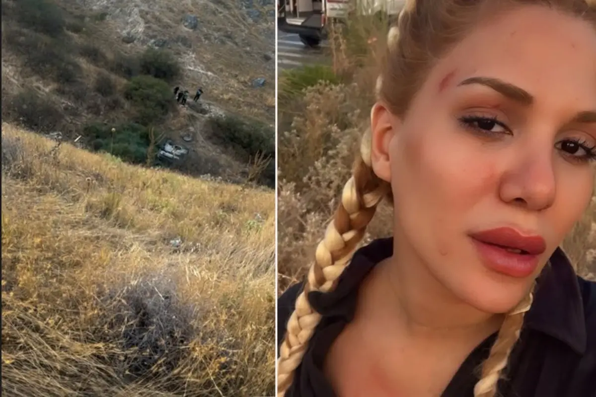 Survivor Almeda Baylan Trafik Kazasında Ölümden Döndü