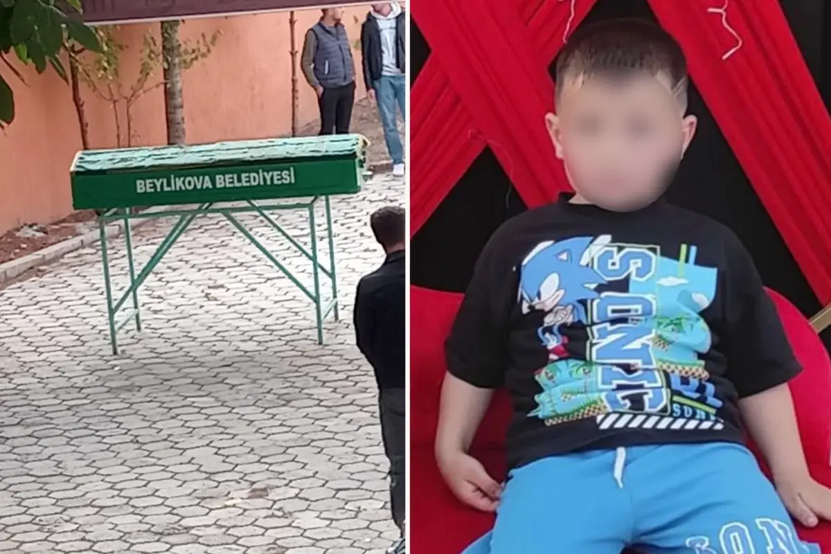 İstanbul Bahçelievler'de Beslediği Köpeğin Saldırısına Uğradı