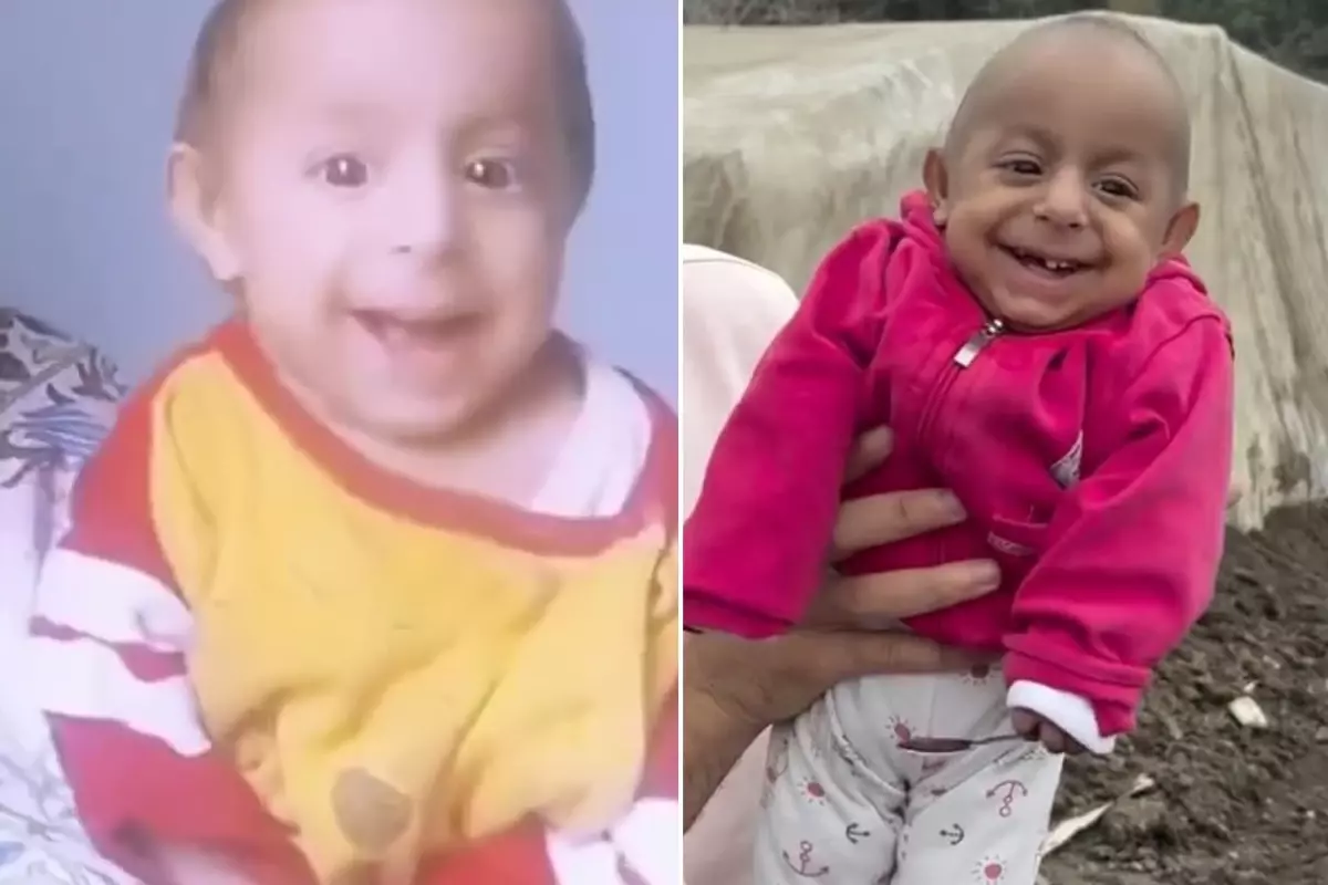Ökkeş Bebek Yaşamını Yitirdi