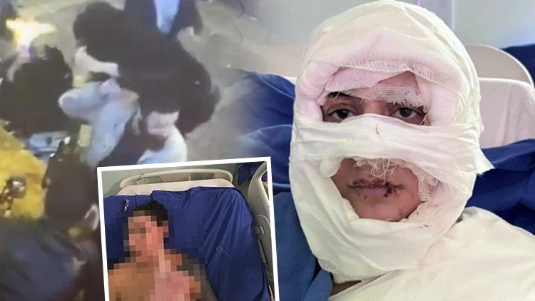 Türkiye Kadıköy'deki Bu Olayı Konuşuyor: Gözde Yılmaz'a Yanıcı Maddeyle Saldırı
