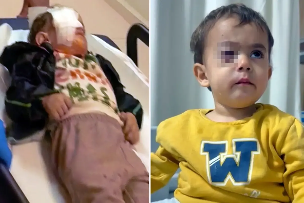 İnegöl’de Torpil Patlaması Küçük Çocuğa Ağır Zarar Verdi