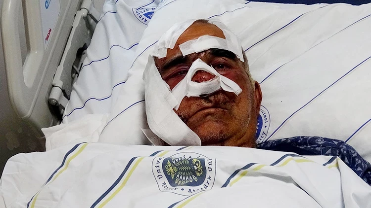 Ağrı’da Ayı Saldırısı: Yaşlı Adam Yüzünden Yaralandı Ağrı’da Ayı Saldırısı: Yaşlı Adam Yüzünden Yaralandı