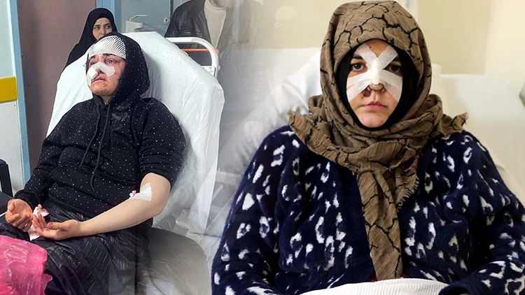 Gaziantep’te Kaldırım Taşıyla Saldırıya Uğrayan Nazlı Yavuz Yardım İstedi