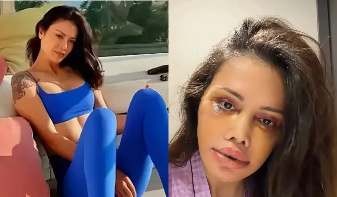 Didem Ceran kimdir? Neden yüz nakli oldu? Didem Ceran kimdir? Neden yüz nakli oldu?