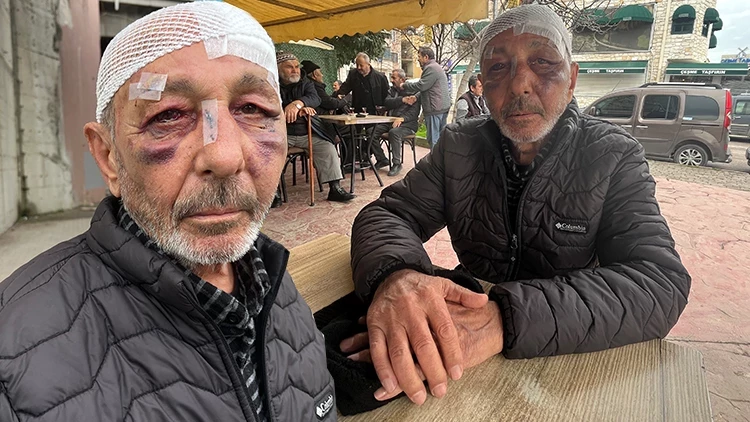 İzmit’te Çakmak İsteyip Saldırdılar: 67 Yaşındaki Ali Aladağ Darbedildi