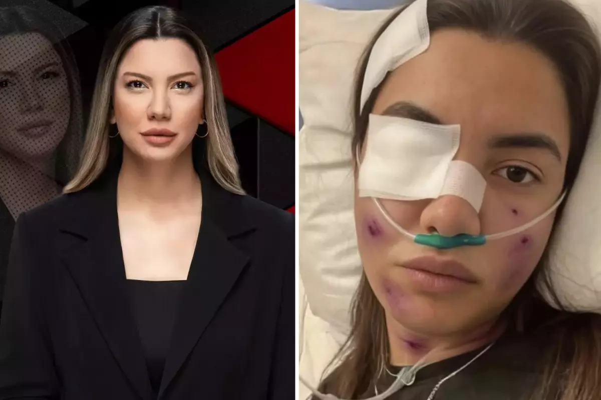 Fulya Öztürk Trafik Kazası Mı Geçirdi? Yapay Zeka Görseli İle İlgili Açıklama Geldi