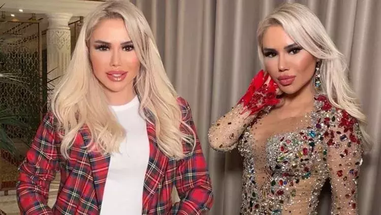 Ceylan’dan Estetik İtirafı Yüzüm Artık Ameliyat Kaldırmıyor