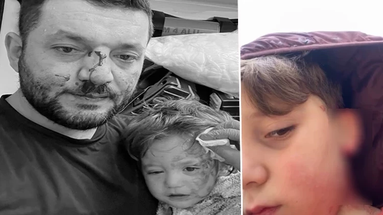 Yalova’da Husumet Büyüdü 8 Yaşındaki Çocuk Taşla Yaralandı Aile Tehdit Edildiklerini Söyledi