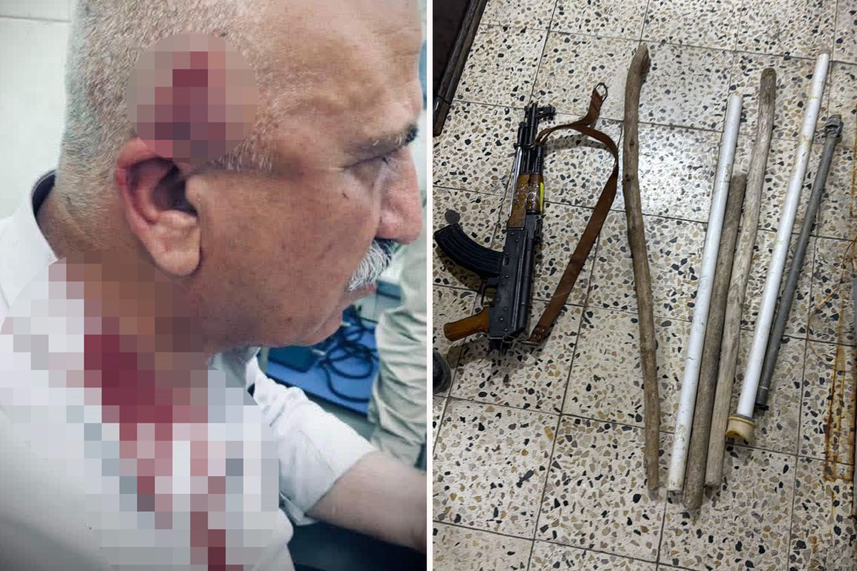 Kerkük’te Kaymakama Bıçaklı Saldırı: Kaçak Yapı Yıkımında Neler Yaşandı? Kerkük’te Kaymakama Bıçaklı Saldırı: Kaçak Yapı Yıkımında Neler Yaşandı?