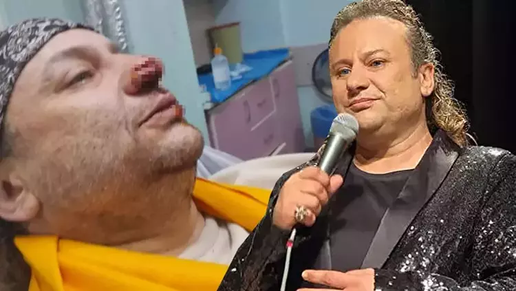 Köpek Saldırısına Uğrayan Onur Akay Entübe Edildi