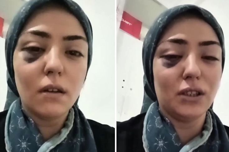 Gaziantep'te Şiddet Gördüğünü Öne Süren 3 Çocuk Annesinden Yardım Çağrısı
